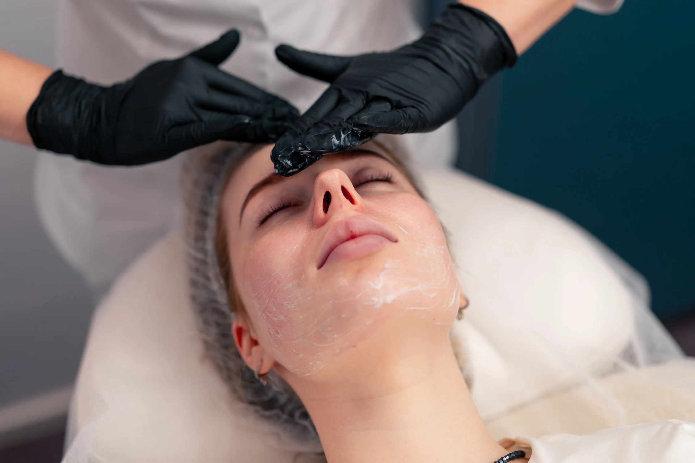 Exfoliación facial