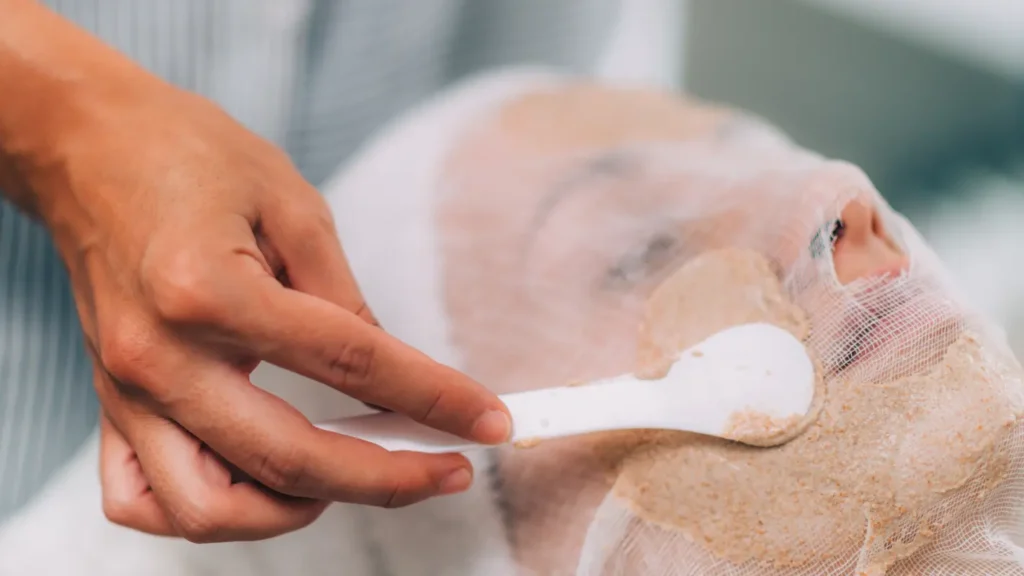Aplicación de ácido glicólico durante un tratamiento ejemplo de que es un peeling facial en consulta médica
