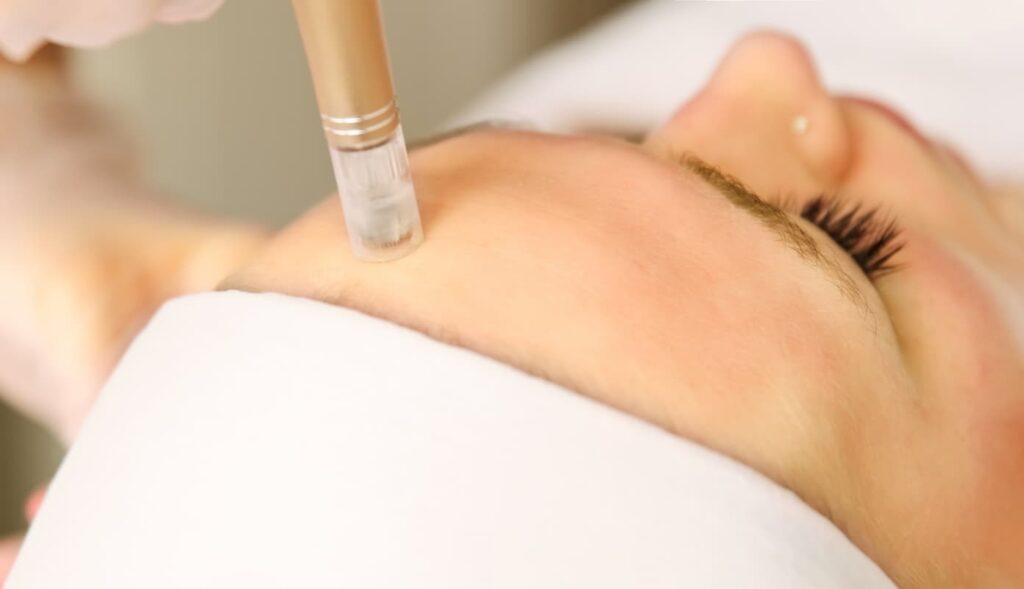 Dermatóloga especialista realizando un tratamiento de punta de diamante facial a una paciente sonriente