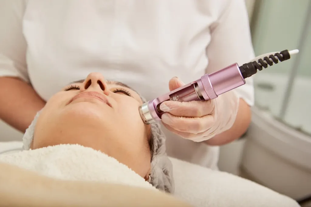 Doctora especialista realizando el tratamiento con dermapen en una clínica dermatológica en Quito