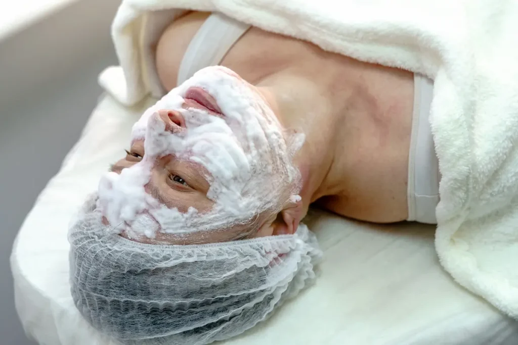 Paciente en clínica estética de Quito recibiendo un tratamiento de rejuvenecimiento facial con polinucleótidos