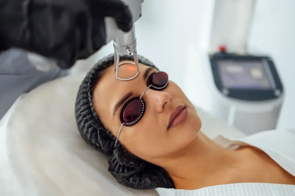 Primer plano médico que muestra detalladamente como queda el rostro despues del laser co2 en su tercer día de evolución natural