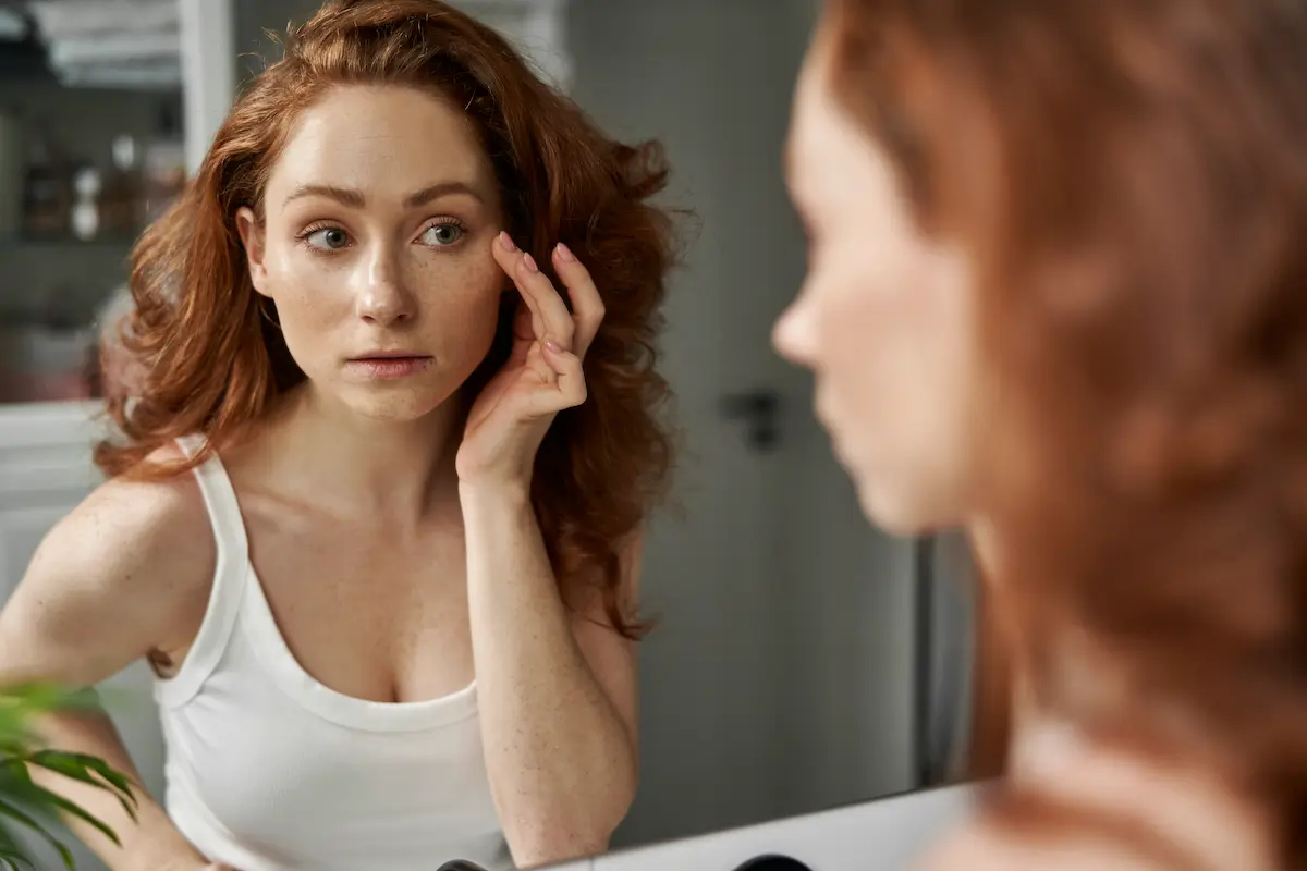 Mujer joven observando en el espejo manchas de melasma en las mejillas